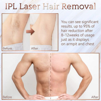 Νέο IPL Αποτριχωτική συσκευή αποτρίχωσης a Laser Μόνιμη Μαλαισιανή μηχανή αποτρίχωσης Face Body Electric depilador a Laser 999999 Flashes