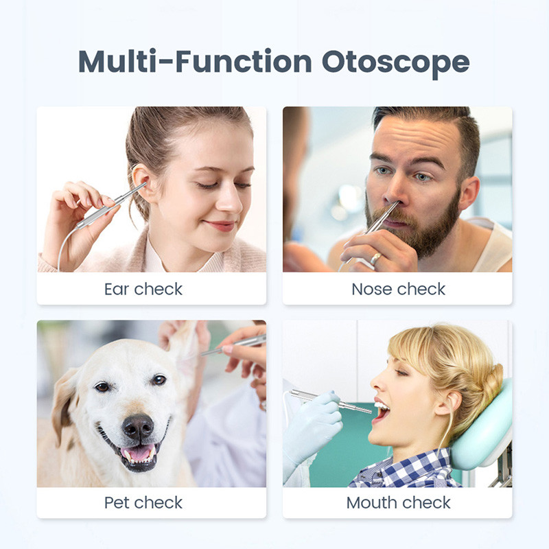 Ψηφιακό ωτοσκόπιο 4,5 ιντσών 1080P HD οθόνη LCD Ενδοσκόπιο κερί αυτιού Κάμερα με μπαταρία 2500 mAh και κάρτα TF 32 GB