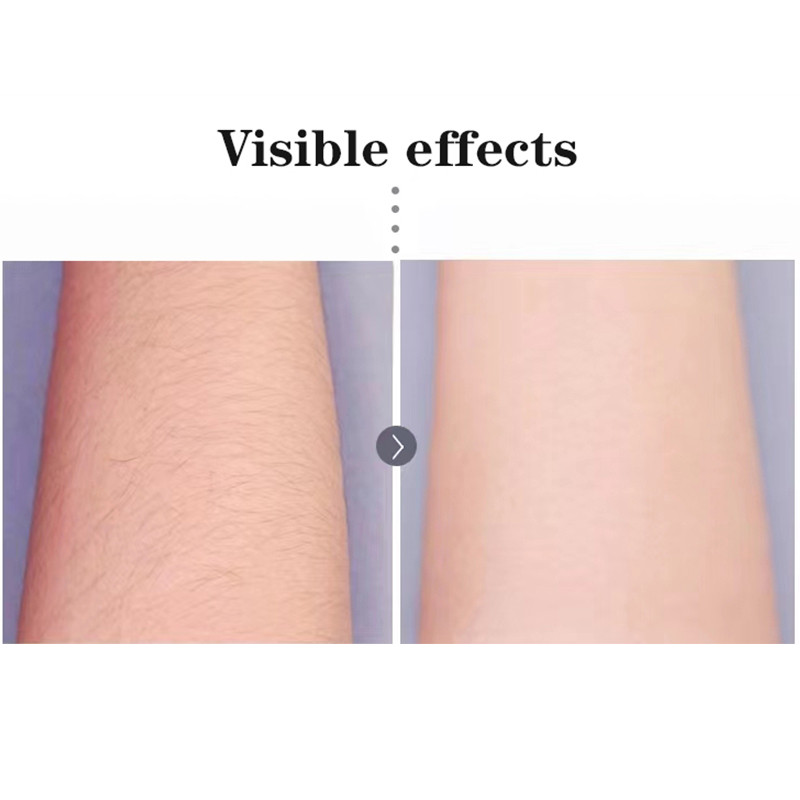 Epilator za žene Uklanjanje dlačica Električni brijač USB punjivi Brijač za žene Ruka Pazuh Bikini Bezbolni Epilator