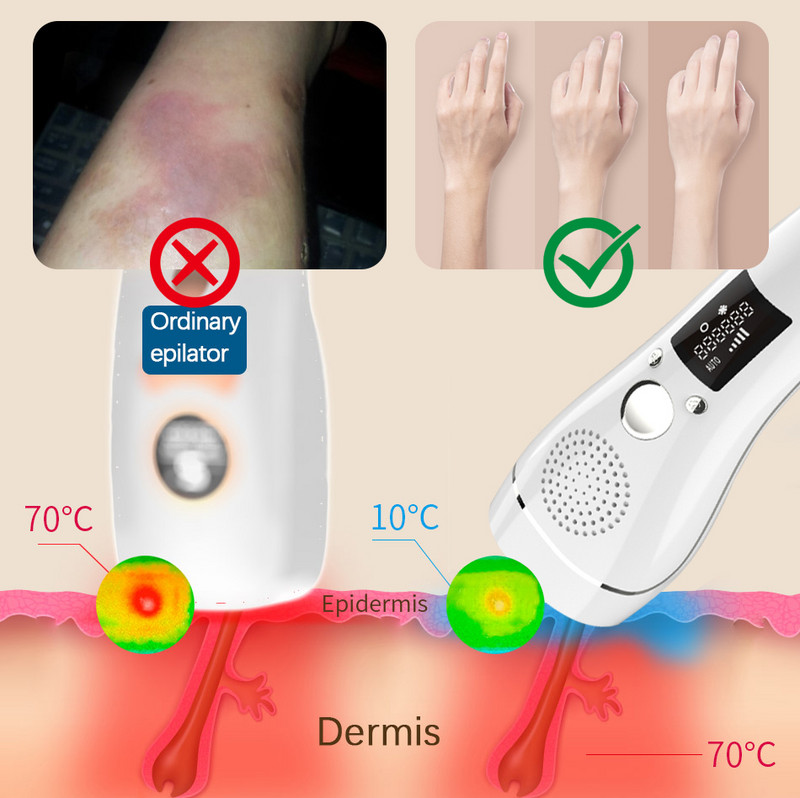 AmazeFan IPL Ice Laser Epilator Permanently Painless 999999 Flash Epilator
