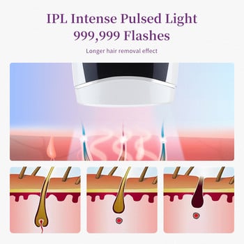 999999 Flashes IPL Laser Αποτρίχωση Αποτρίχωση Παλμική Φωτοαποτρίχωση Μόνιμη Ανώδυνη Ηλεκτρική Μηχανή Αποτρίχωσης Σώματος