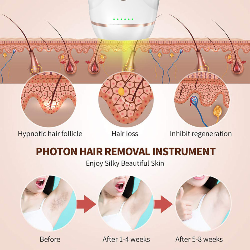990000 Flash Painless IPL Αποτρίχωση Laser Γυναικεία Μόνιμη ηλεκτρική μηχανή αποτρίχωσης Γυναικεία φωτοαποτριχωτική αποτρίχωση μπικίνι