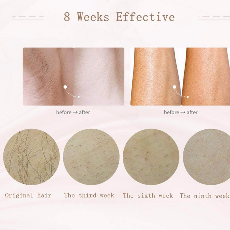 Mlay IPL Laserski epilator za uklanjanje dlačica za žene Profesionalni epilator a laserska upotreba za uklanjanje dlačica na tijelu, bikini, licu 500000 Flash