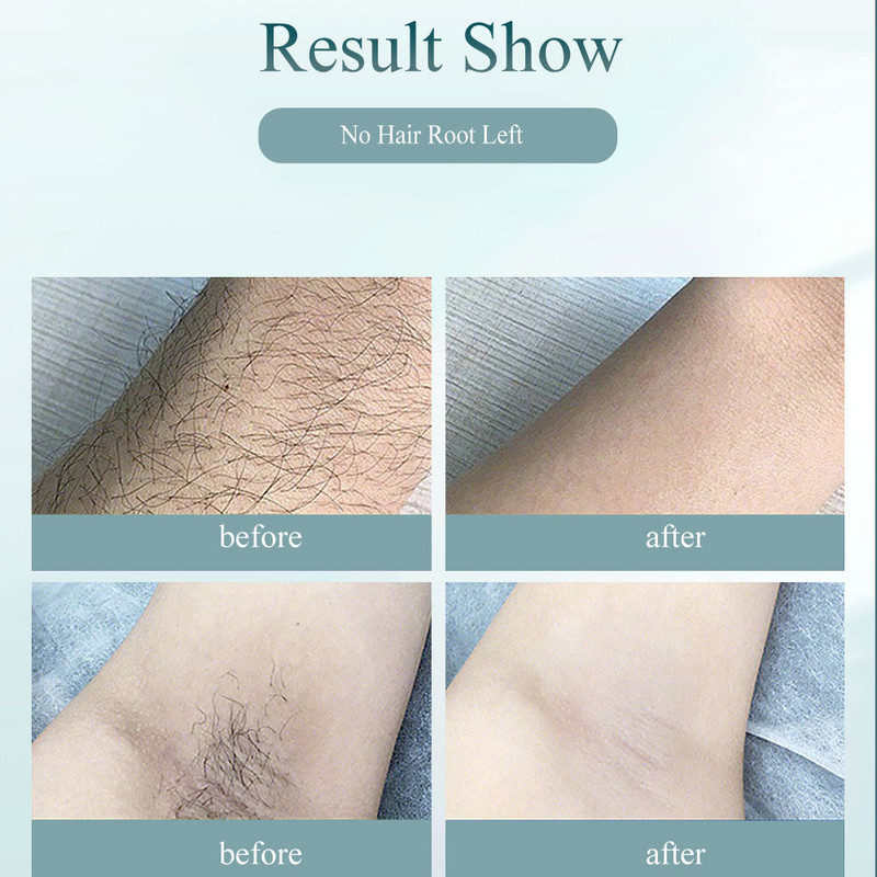 Naujas IPL plaukų šalinimo epiliatorius Lazerinis nuolatinis malajiečių plaukų šalinimo aparatas Veido kūno elektrinis depiliatorius a Laser 500000 blyksnių