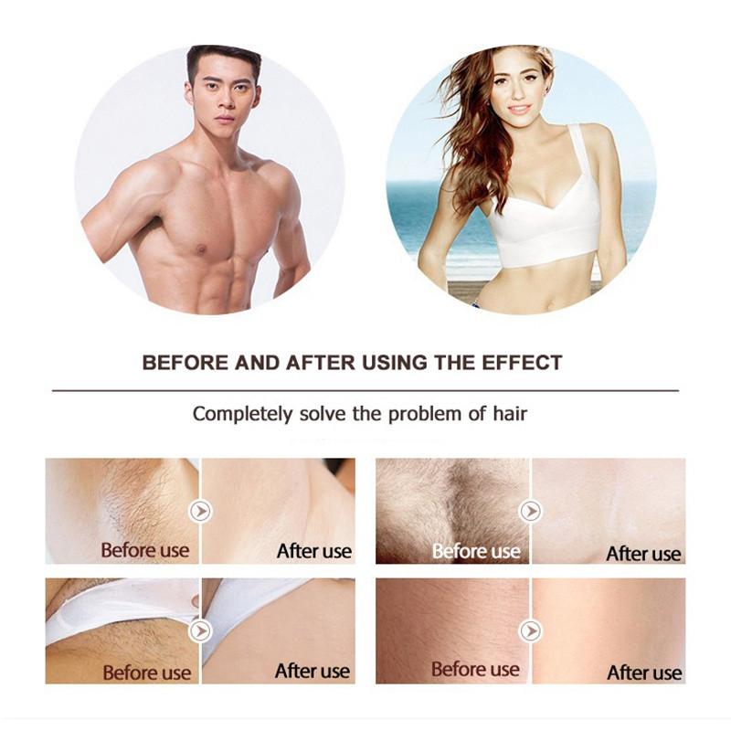 Lescolton IPL lazerinis epiliatorius 1300000 Flashes T009i skutimosi ir plaukų šalinimo nuolatinės namų įrangos fotoepiliatorius.