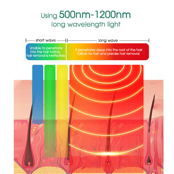 [ZS] LCD 990 000 светкавици 6-степенен спрей за тяло за крака за постоянна лазерна епилация за жени Бикини Домашен преносим IPL епилатор