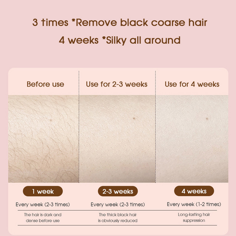 [ZS] IPL Laser Epilator 9900.000 Flash Ice Cooling Ανώδυνες Μόνιμες Μασχάλες Πίσω Πόδια Συσκευή αποτρίχωσης μπικίνι για γυναίκες