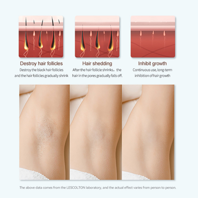 Lescolton IPL plaukų šalinimo skystųjų kristalų lazerinis epiliatorius ICE Cool neskausminga ilgalaikė fotoepiliacija vyrams moterims namų elektrinis depiliatorius