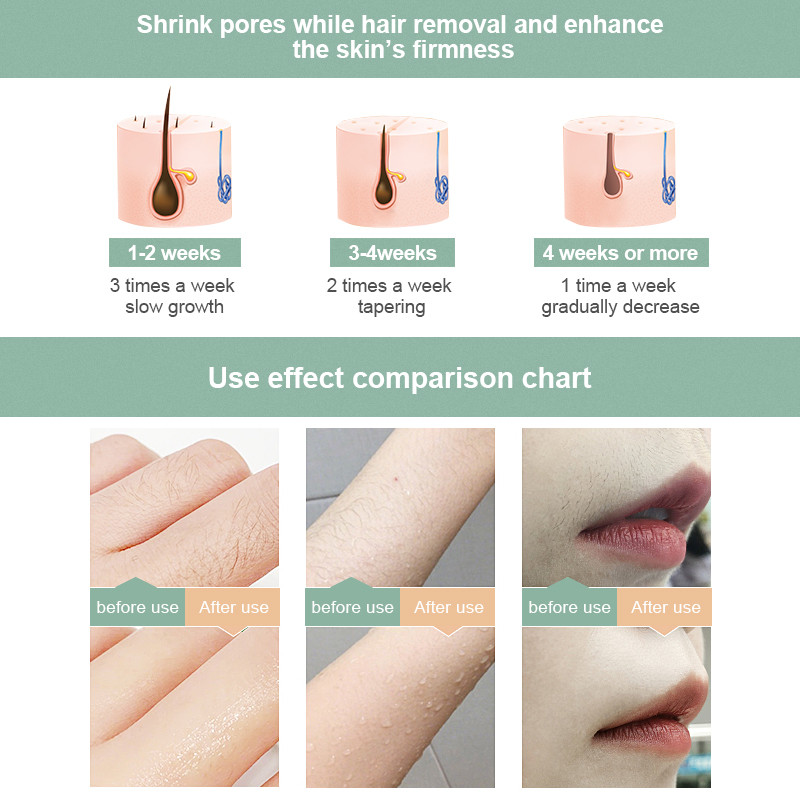 IPL plaukų šalinimo epiliatorius ir nuolatinio plaukų šalinimo lazeriu aparatas Veido kūno elektrinis depiliatorius lazerinis depiliatorius 990000 Flashes