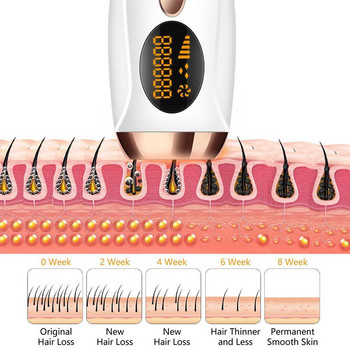 Όργανο αποτρίχωσης Beauty Salon Rejuvenating Hair Machine Photon Removal Painless Instrument Hair Removal Ipl Freezing S3I0