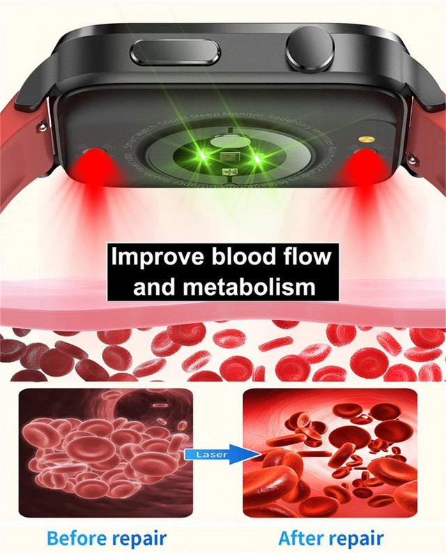 2023 Uus nutikell meeste hüpertensiooni laserravi hüperglükeemia hüperlipideemia südame löögisageduse tervislik monitor, naiste nutikell