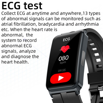 EP01 Кръвна захар Захар Интелигентен часовник с каишка Телесна температура ЕКГ HRV Мониторинг Фитнес Смарт гривна Водоустойчив SpO2 Смарт часовник
