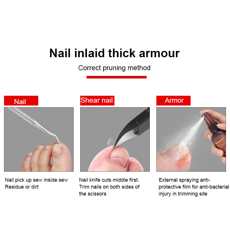 Profesionalios kojų nagų kirpimo mašinėlės pašalina negyvą odą Nagų koregavimo žnyplės įaugusių nagų odelių žirklinė kraštų kirpimo priemonė
