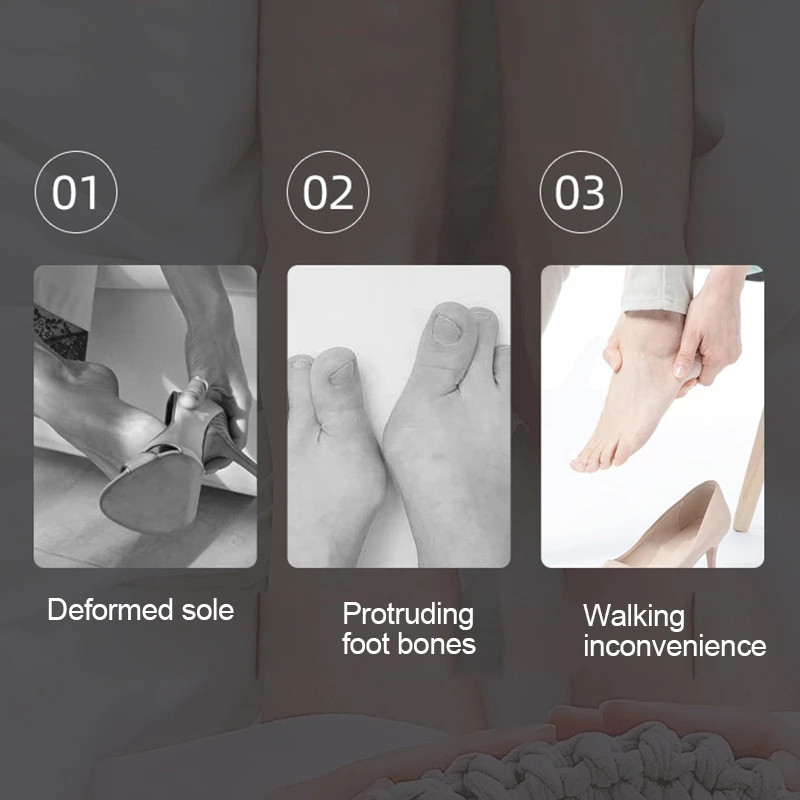 2tk = 1 paar pehmet geelist varvaste eraldaja vahetükid Bunion Correctori kattuvate varvaste sirgendaja jalahooldustööriista kaitsvate kanderaamide jaoks