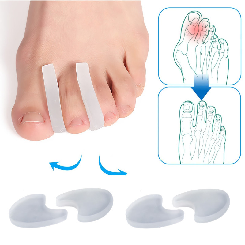 4 komada = 2 para Silikonski odvajači nožnih prstiju Adjuster čukljeva kosti Hallux Valgus korektor Alati za njegu stopala Odstojnik za palac Štitnik