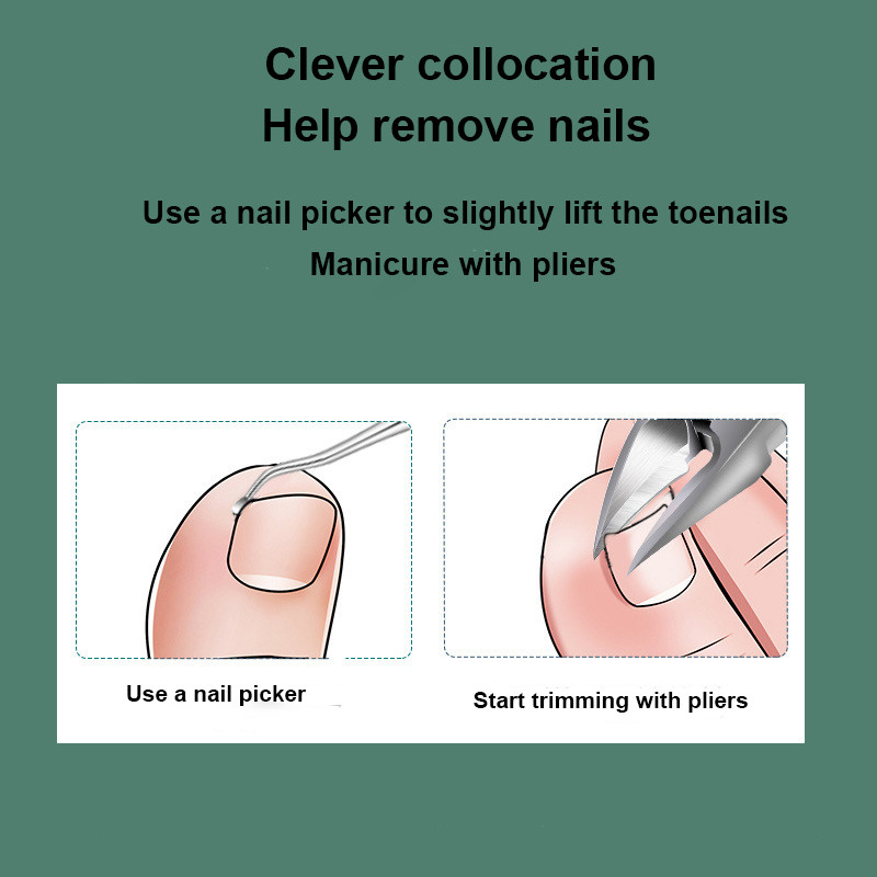 Körömvágók Benőtt köröm Eszközök Pedikűr Manikűr Olecran Professzionális vastag Paronychia korrekciós eszköz Dropshipping