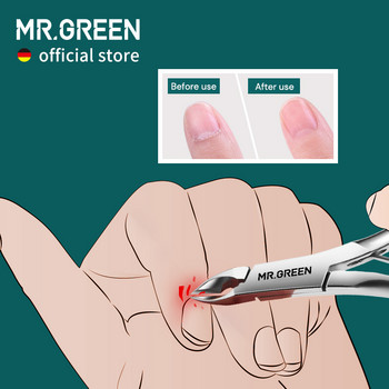 MR.GREEN Cuticle Nippers Μανικιούρ νυχιών Μανικιούρ Επωνύχια Ψαλίδι Κόπτη Ψαλιδάκι Περιποίησης Πεντικιούρ Dead Skin Remover Εργαλείο κοπής από ανοξείδωτο ατσάλι