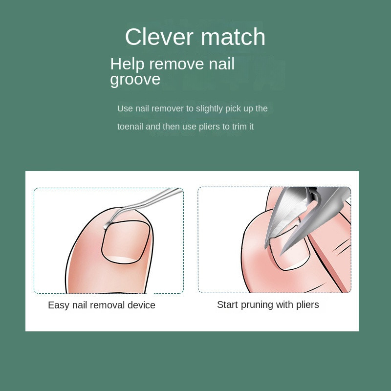 Kojų pirštų nagų kirpimo žirklės pašalina negyvą odą Nagų koregavimo žnyplės įaugusių nagų odelių žirklinė kraštų kirpimo priemonė stora pedikiūro priežiūros priemonė