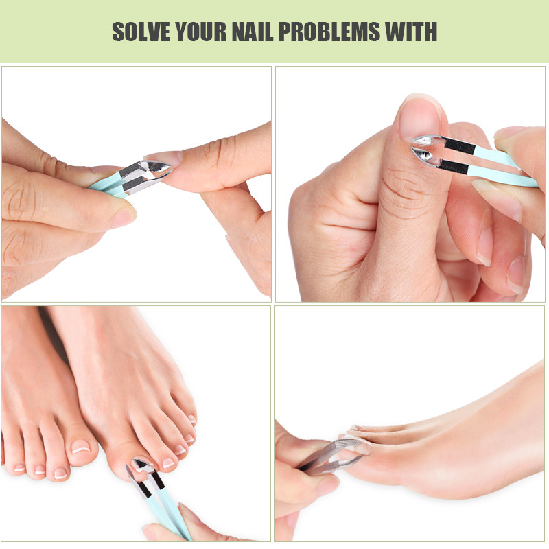 Mini škarice za nokte Rezači zanoktica Nokti Klješta za zanoktice Rezači za mrtvu kožu za manikuru Škare za nokte Pedikura Alati za urasle nokte