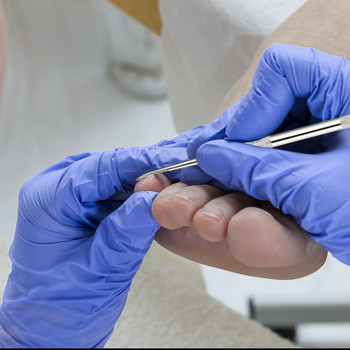 6 ΤΕΜ/ΣΕΤ Κιτ εργαλείων μανικιούρ Πεντικιούρ Νυχοκόπτη Σετ Nipper Pedicur Cuticle Scissors Ingrown Toenail Correction Podiatry