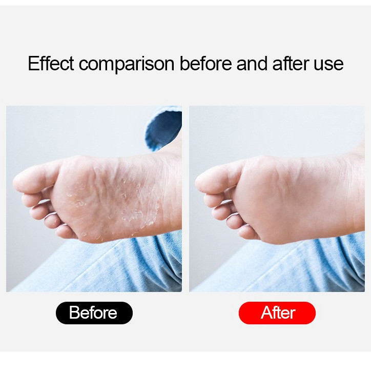 Pėdų dildė pėdų šveitiklis Profesionalus pėdų rasp kulno trintuvas kietos negyvos odos nuospaudų šalinimo priemonė pedikiūro pėdų priežiūros priemonės