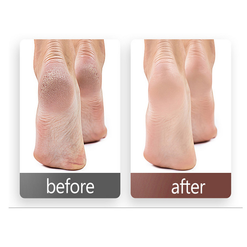 FILI ketaspadjad vahetatav lihvpaber koos ketasjala kallusega küünenaha kalluse eemaldamise tööriist liivapaberi pediküüri tööriista jaoks 50 tk/karp