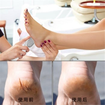 Ξύστρα λίμας ποδιών για πεντικιούρ Callus Dead Skin Remover από ανοξείδωτο ατσάλι Φορητό Rasp Colossal Foot Triter Scrubber Wet Dry Foot Care