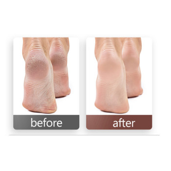 Δίσκοι περιποίησης ποδιών Επιθέματα για πεντικιούρ γυαλόχαρτο για σκληρό δέρμα αφαίρεσης σκληρού δέρματος Ηλεκτρικό γυαλόχαρτο αντικατάστασης λίμας ποδιών