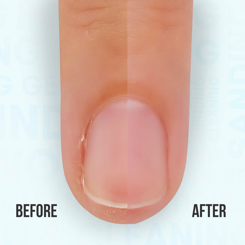 Professzionális Nature Nail Buffer Bit Grit 3XF a Nail Art Design Cuticle eltávolításához Manikűr Köröm Kiegészítők Otthoni és szalon használatra