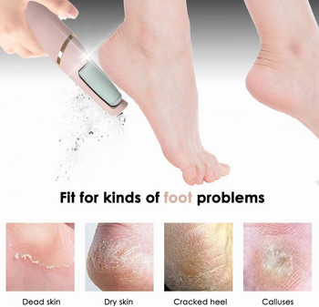 FOOT FILE ELECTR Ηλεκτρικό μηχάνημα αφαίρεσης κάλων ποδιών Πεντικιούρ Μύλος ποδιών Rasp Tool Foot γυαλόχαρτο Clean για σκληρό ραγισμένο δέρμα