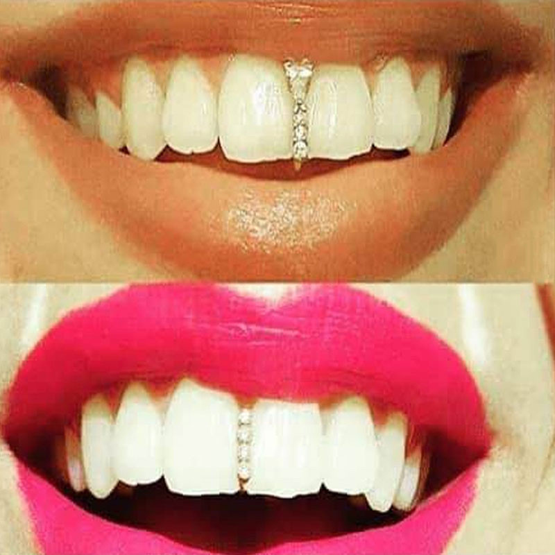 strass dentaire Capace de dinti Hip Hop Rapper Rock Teeth Cover Gratare Carcasa pentru dinti Bretele Clips de dinti cu stras Bijuterii de petrecere hip hop