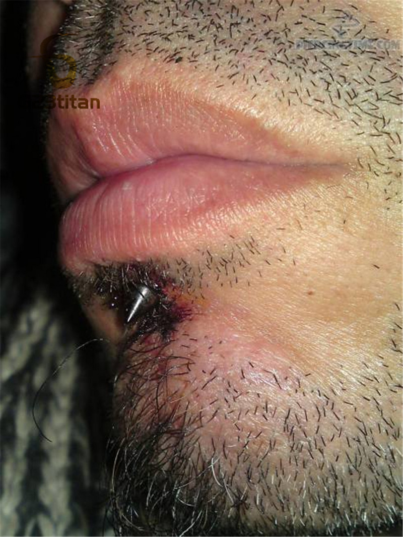 16G hipoallergén titán piercing gyűrűk patkó kör alakú ívelt súlyzó banánbell labret fogságban lévő gyöngyök testékszerek