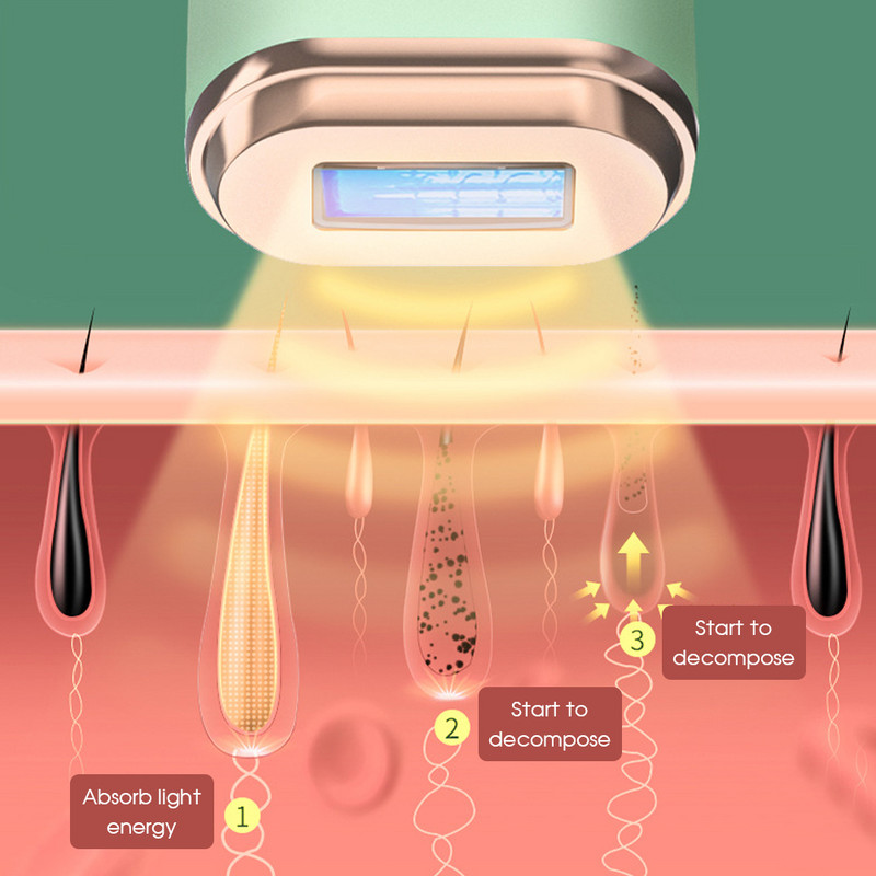 [ZS] Μηχάνημα αποτρίχωσης Infinite Flash Laser 5 Gears IPL Permanent Epilator Electric Depilador Ανώδυνο σώμα προσώπου για γυναίκες