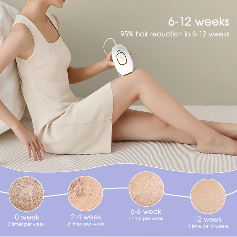 [ZS] Dispozitive de uz casnic de marcă Epilator Bikini Corp 500.000 de flash-uri Dispozitive de îndepărtare a părului cu laser IPL fără durere pentru femei Depilare permanentă