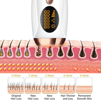 Инструмент за епилация Салон за красота Подмладяваща коса Безболезнен фотонен инструмент Ipl Removal Премахване Машина за замразяване на косата Z8R8