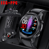 Ceas inteligent Bărbați Glicemie Tensiune arterială Temperatura corpului Ceas de monitorizare a sănătății Ceas inteligent pentru femei Glicemie neinvazivă