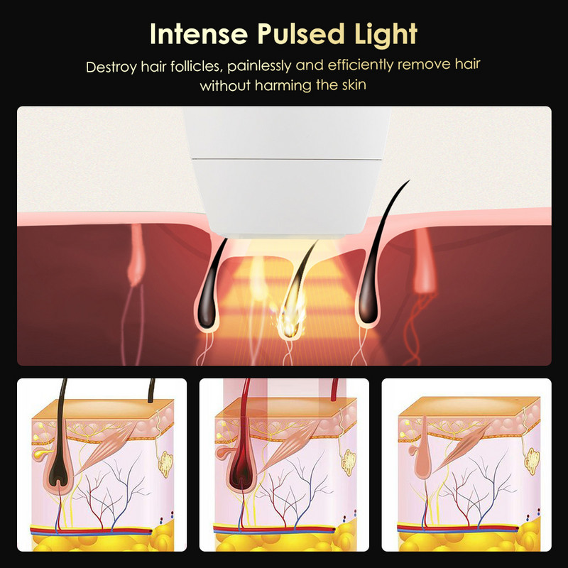 Body Bikini IPL 500.000 Flash Depilator Pulses Μόνιμη Αποτρίχωση Laser Ανώδυνη Γυναικεία Αποτρίχωση Συσκευές Οικιακής Χρήσης