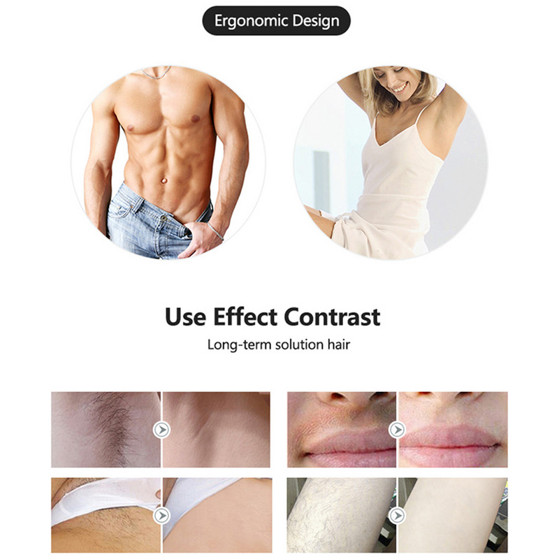 FIEEZOE Laser Epilator 900000 Flash IPL Hair Removal Laser Permanent Epilator For Women Ανώδυνη Φωτοαποτρίχωση Προσώπου Depiladora