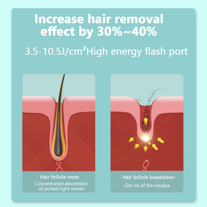 YUKUI Mini IPL Hair Remove Device 990000 Flash-Support TYPE-C To Work Αποτρίχωση μέσω τηλεφώνου και διαχείριση της διαδικασίας για γυναίκες