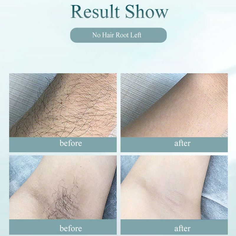 Epilator laser cu 900000 de flash-uri Fotoepilator IPL ușoară, fără durere, pentru îndepărtarea părului, depilatoare cu afișaj LCD permanent, aparat de epilat