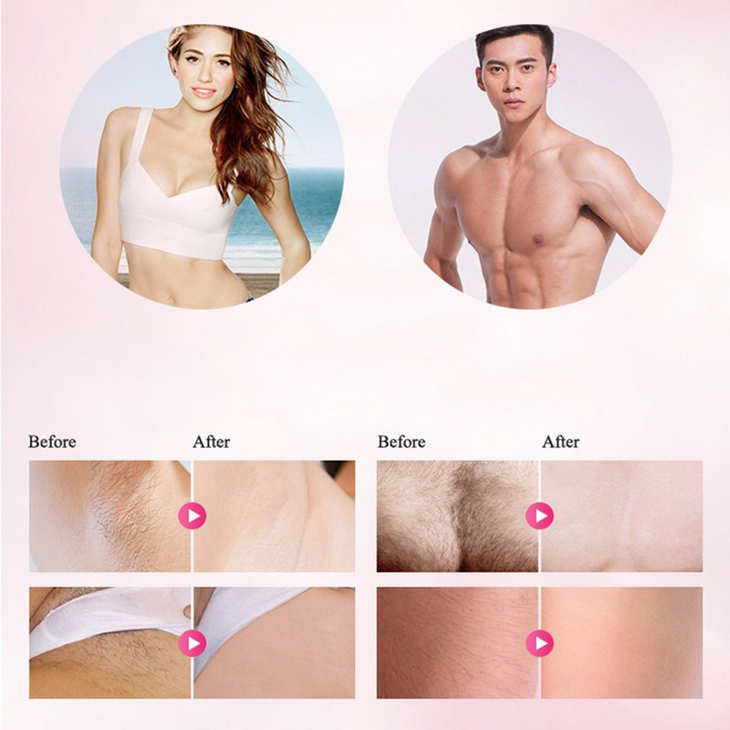 Оборудване за епилация Мини домашен салон за красота Перманентен уред за интимни части на подмишниците Безболезнено устройство за епилация на тялото