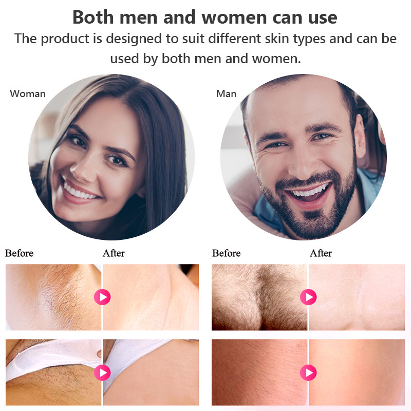 ÚJ szőrtelenítő professzionális tartós lézeres epilátor nőknek 600000 Flash LCD kijelzős Bikini IpL lézeres szőrtelenítő gép