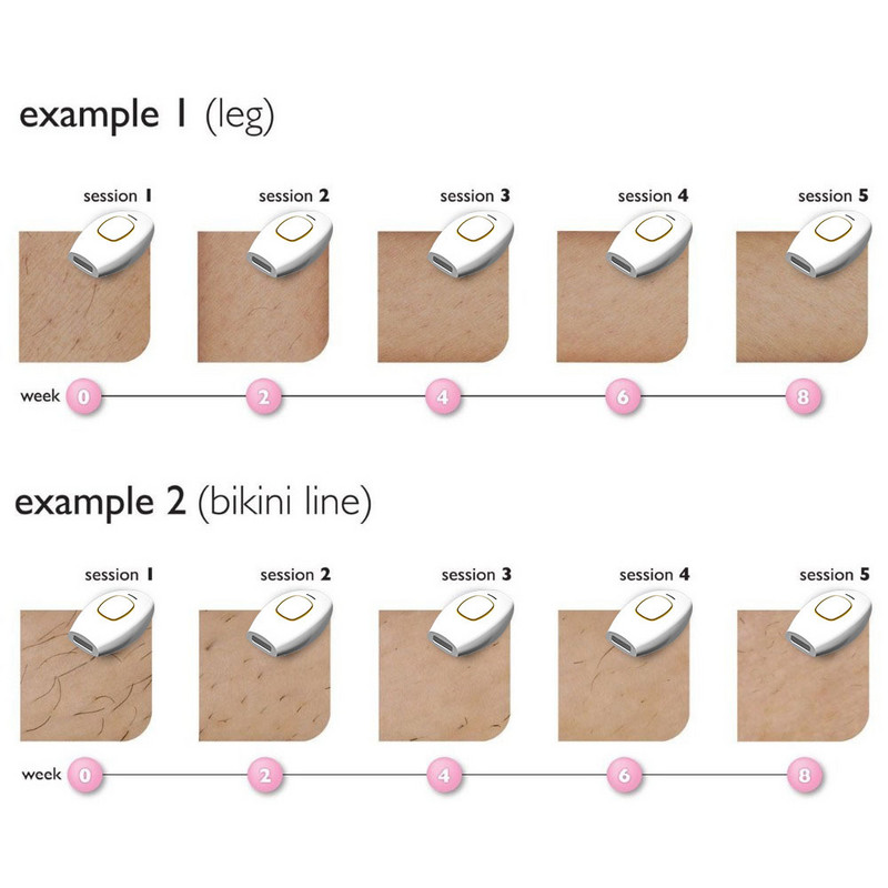 Hot Sell Laser Epilator Permanent IPL Photoepilator Laser Αποτρίχωση Depiladora Painless Electric Epilator For Women Ξυριστική μηχανή