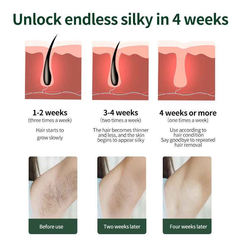 Epilator cu laser Flashuri fara durere 999999 Epilarea IPL Femei Dispozitiv de indepartare permanenta a corpului facial Epilator electric cu laser