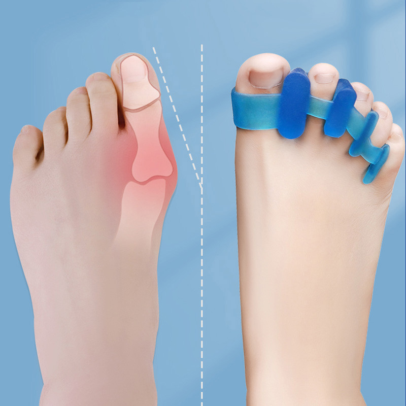 Kojų pirštų skyriklis Hallux Valgus Korektorius Bunions Finger Separator Pirštų korektorius Pirštai Pėdos Haluksy Kojų pirštų sklaidiklis Bunion Corrector