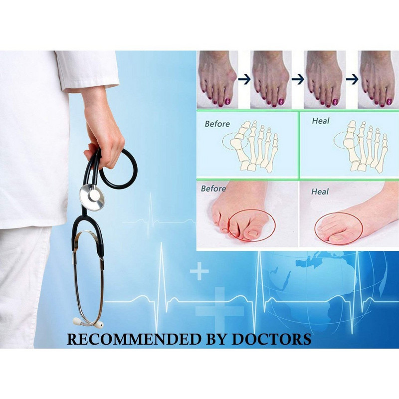 Zaštitni štitnik za nožne prste od 4 komada Silikonski korektor za čukljeve Materijal Mekani gel Ispravljač Odstojnici Nosiljka Alat za njegu Separator