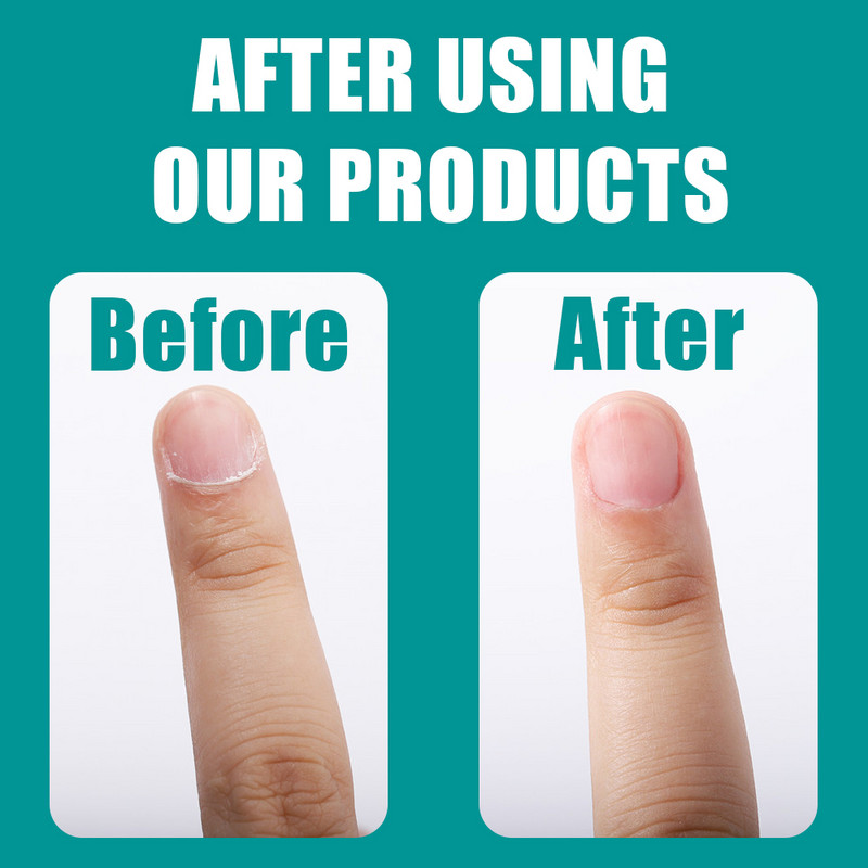 Foarfece profesionale pentru cuticule din oțel inoxidabil pentru îndepărtarea pielii moarte pentru unghii pentru unghii Foarfece pentru unghii pentru manichiură cu vârf curbat