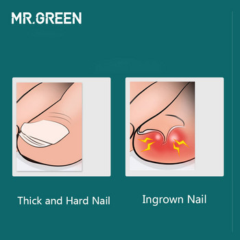 MR.GREEN Εργαλεία μανικιούρ Επαγγελματικά νύχια από ανοξείδωτο ατσάλι χοντρά νύχια κοπής νυχιών με πένσα ψαλίδι νυχοκόπτη
