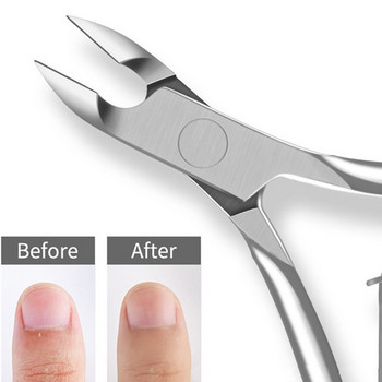 Професионални ножици за премахване на кожички Ножици Грижа за пръстите Маникюр Нокторезачка Инструменти за мъртва кожа Неръждаема стомана на едро