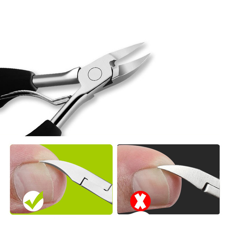 Taoye teemo 1 buc Clips de unghii pentru degetele de la picioare Clape de corectare a unghiilor Cuttere de tăiat pentru îndepărtarea murdăriei pentru piele moartă Podiatrie Pedichiură Instrumente de îngrijire